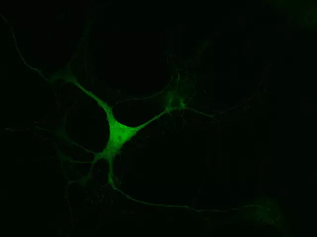 L.Phenyl-Alanine imaging in mouse embryonic midbrain neurons