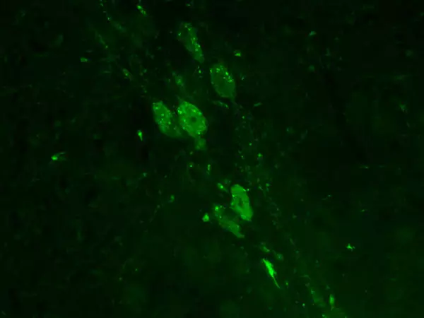 Immunostaining of 5HT cells in the pons of adult mouse brain, sagittal slice