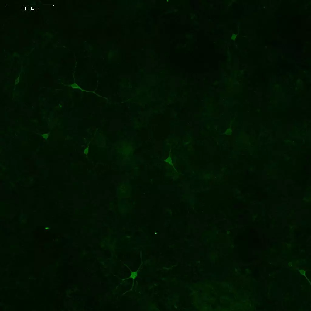 L.Tyrosine imaging in mouse embryonic midbrain neurons