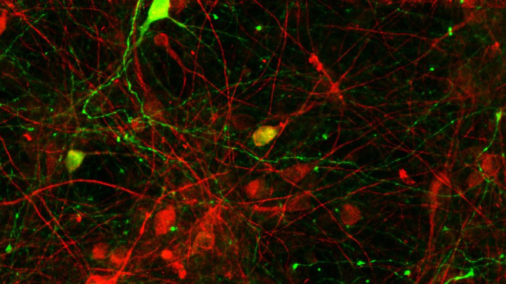 PICTURE OF THE WEEK: Serotonin in primary mesencephalic cells