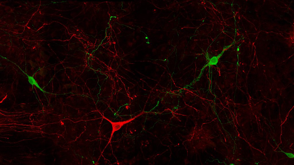 Dopamine (green) & Serotonin (red) in mouse primary neuronal culture using STAINperfect immunostaining kit with IS1005 (DA pAb) and IS1035 (5-HT pAb)