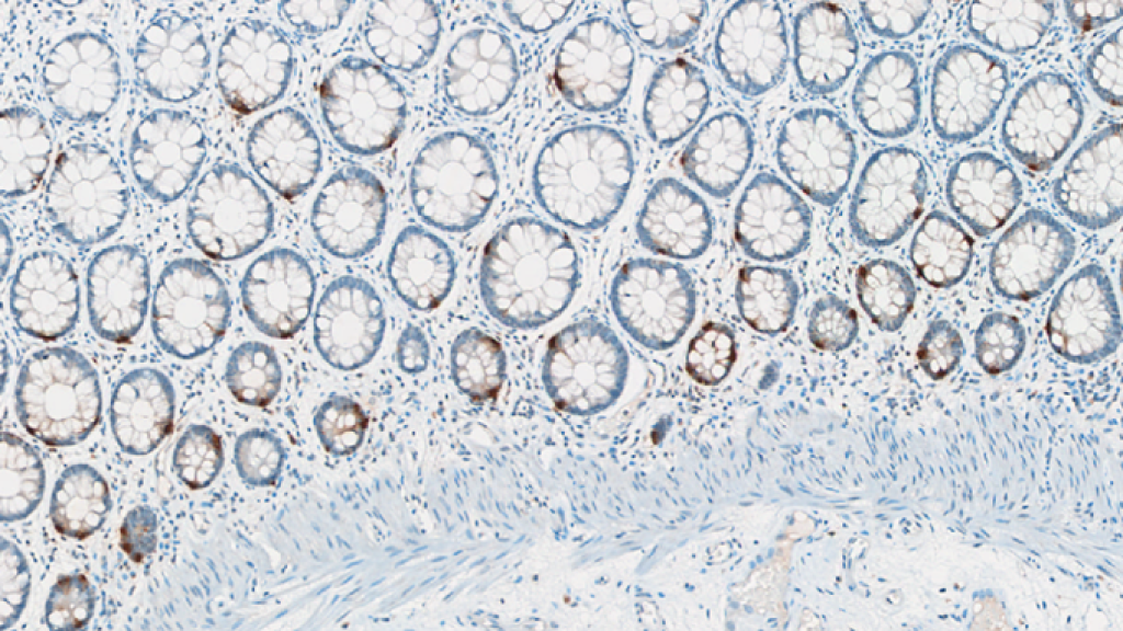 5HT immunoreactivity, revealed using anti-serotonin (5HT, rabbit polyclonal antibody #IS1086), is highlighted in enterochromaffin cells of the intestinal mucosa.