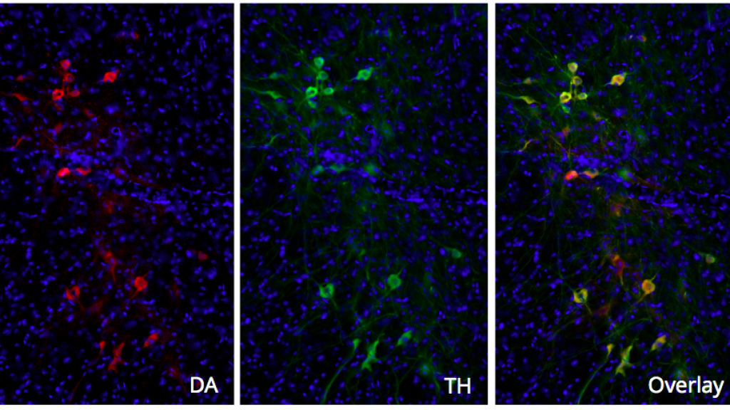 Take the opportunity of a special offer to try our Dopamine Ab