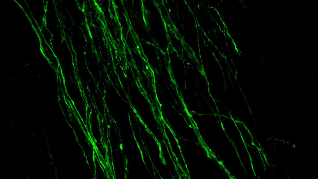 PICTURE OF THE WEEK: Dopamine staining in embryonic mouse brain