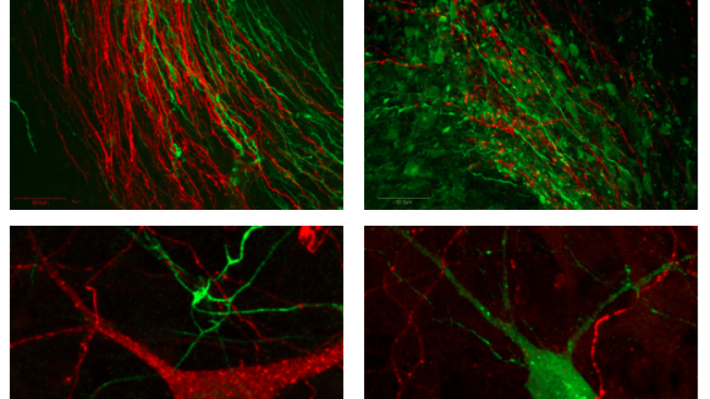 Get access to the Dopamine and Serotonin crosstalk using STAINperfect immunostaining kit