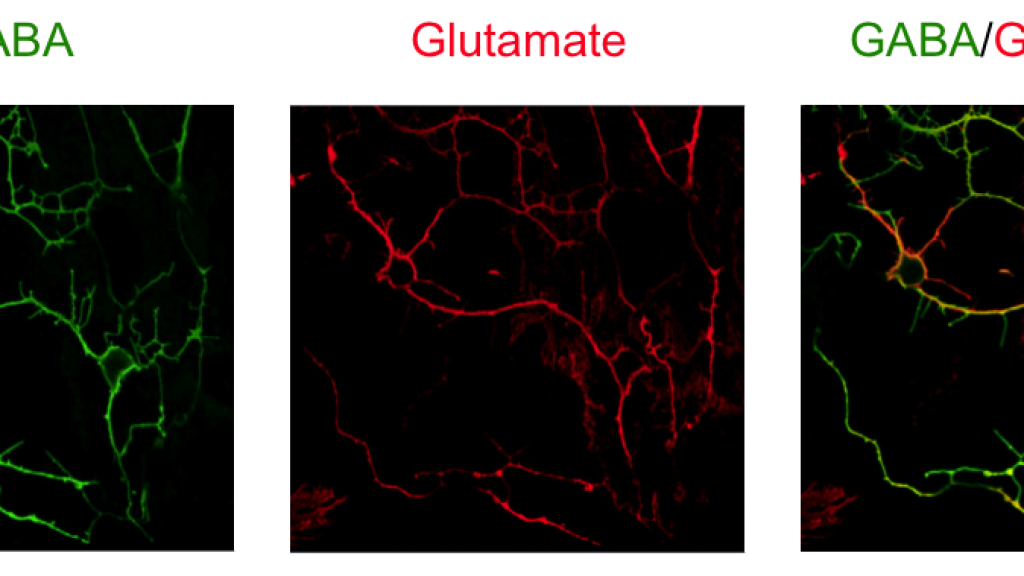 Neurotransmitter imaging: Differential organization of two key neurotransmitters within neurons revealed by STAINperfect kit