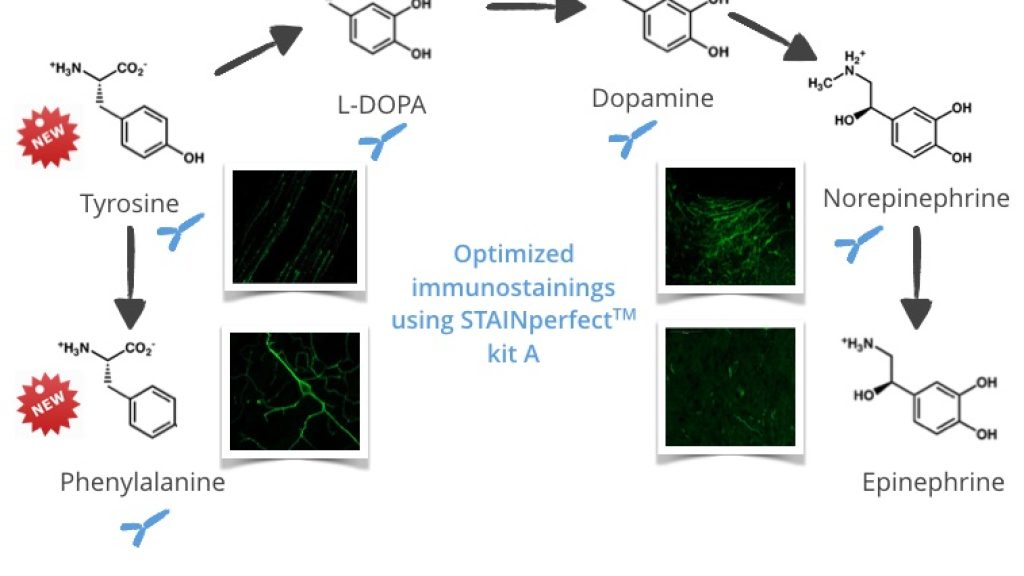 A range of validated antibodies to assess catecholamines
