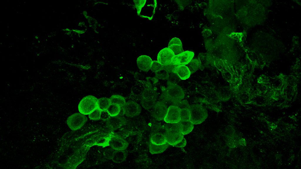 PICTURE OF THE WEEK: L-Glutamate in crayfish brain