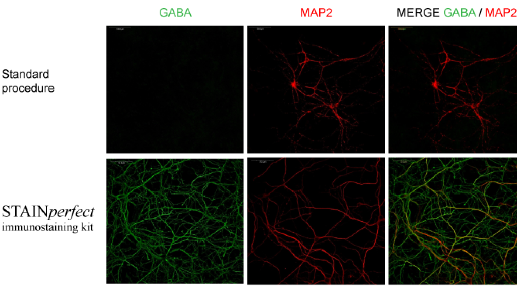 Neurotransmitter imaging protocols: Standard procedure versus STAINperfect immunostaining kit
