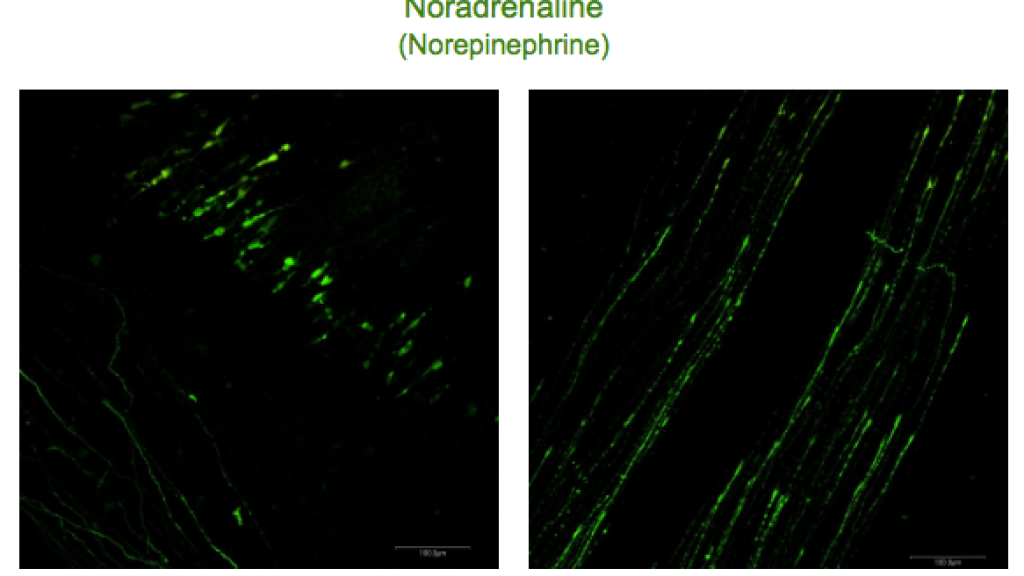 New antibody for Noradrenaline now available using STAINperfect immunostaining kit
