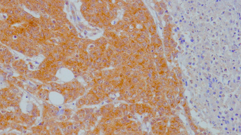 ImmuSmol is releasing a series of rabbit polyclonal antibodies against Tryptophan/Kynurenine metabolites. See IHC validation pictures in human tissues.